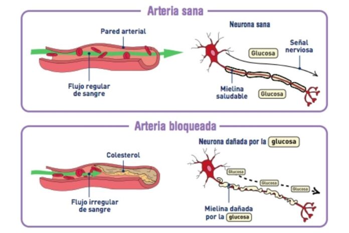 Problemas Sexuales Relacionados Con La Diabetes Imagazine Soluciones Para La Diabetes 4484